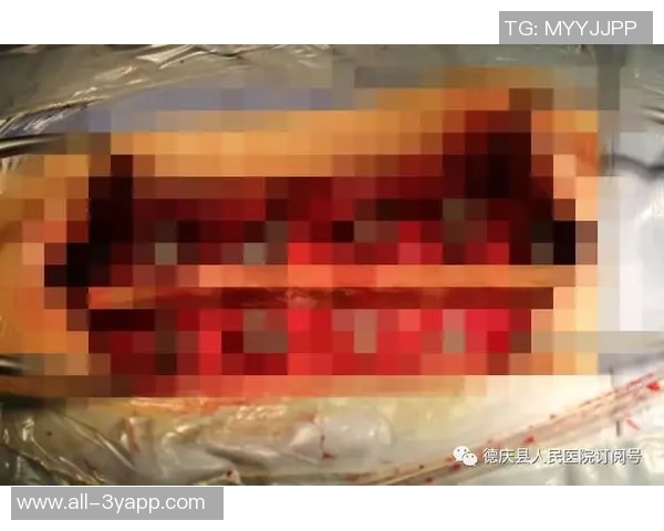 弗兰克透露比尔骨折如同车祸这并非常见篮球伤病